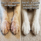 Yeast Infection Drops™